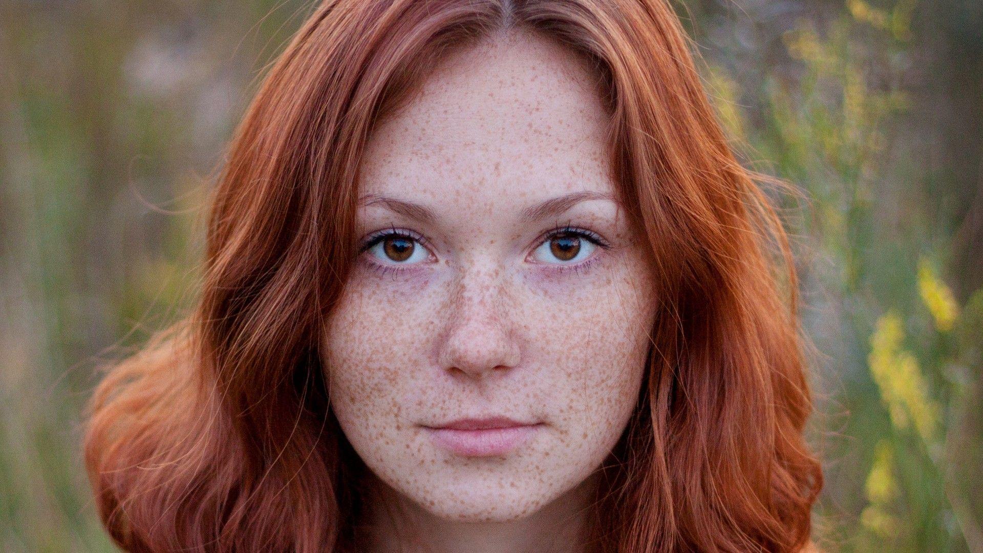 Freckles solo photo