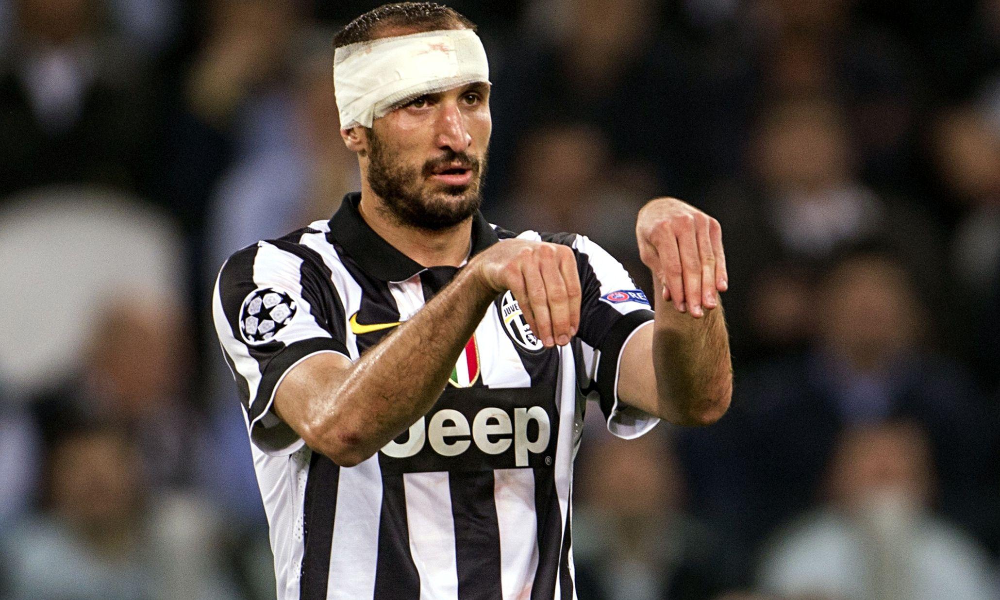 638x382px 40.36 KB Chiellini