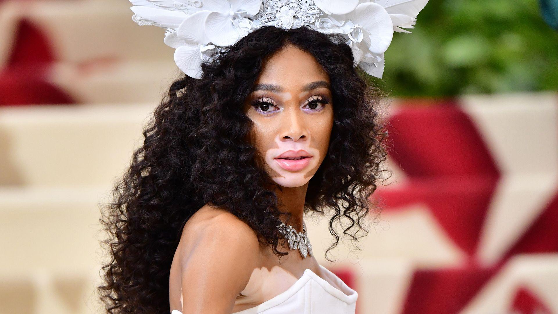 Winnie Harlow Disses 'America's Next Top Model'