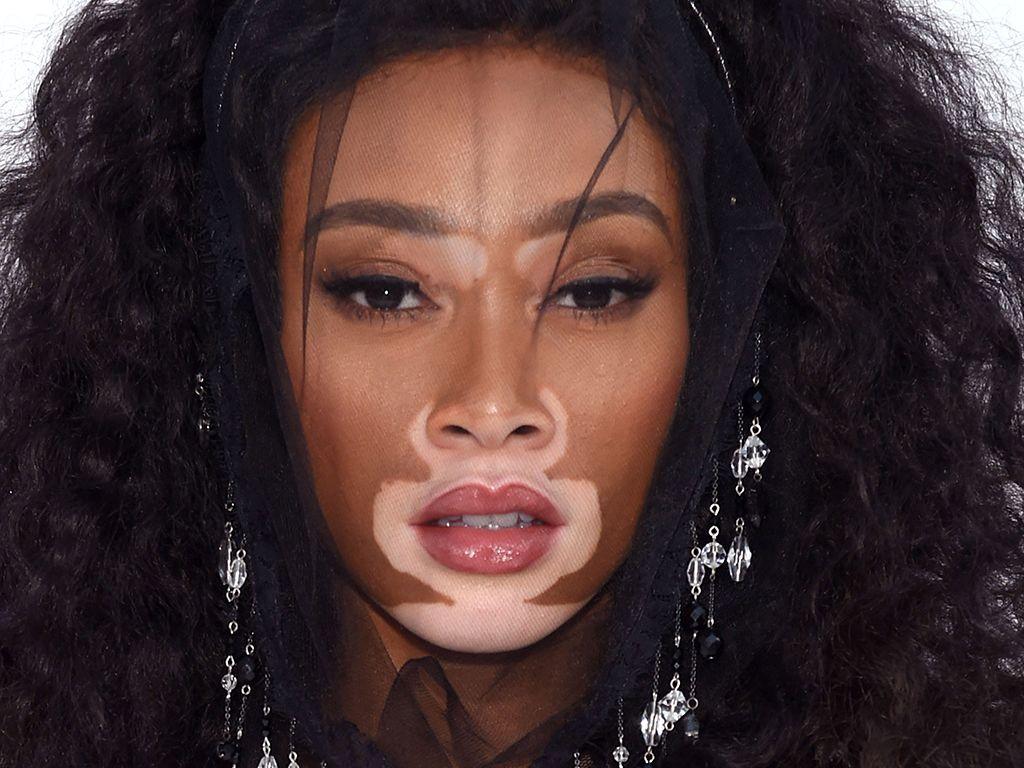 Winnie Harlow: 'It's Beautiful That The Age Of Cookie Cutter Models