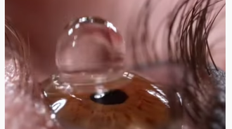 what eye drops really look like when they go to your eye 0-0