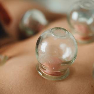 Cupping therapy wallpaper