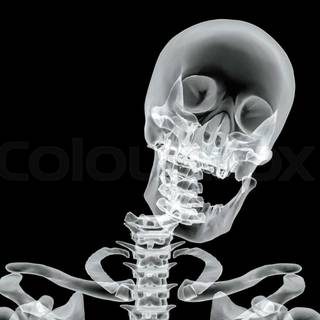 Broken bones wallpaper