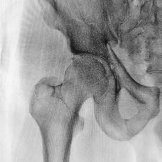 Broken bones wallpaper