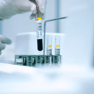 Blood test wallpaper