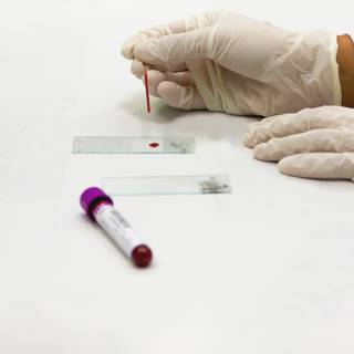 Blood test wallpaper