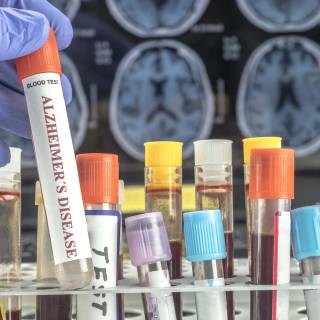 Blood test wallpaper