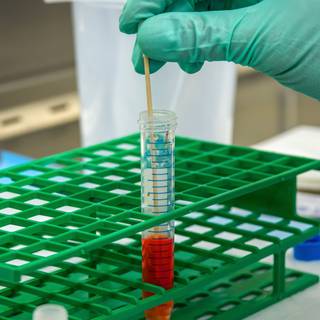 Blood test wallpaper