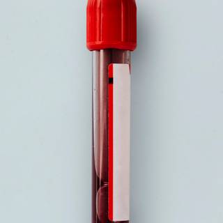 Blood test wallpaper