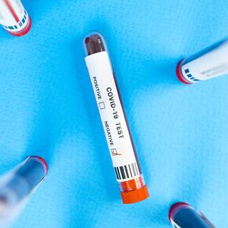 Blood test wallpaper