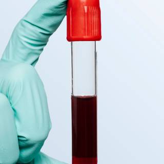 Blood test wallpaper