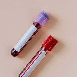 Blood test wallpaper