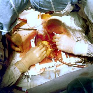 Heart surgery wallpaper