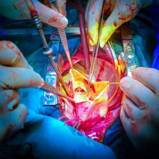 Heart surgery wallpaper