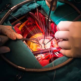 Heart surgery wallpaper