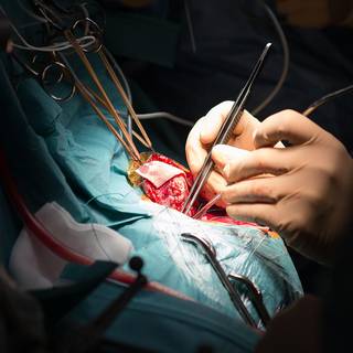 Heart surgery wallpaper