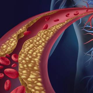 Cholesterol wallpaper