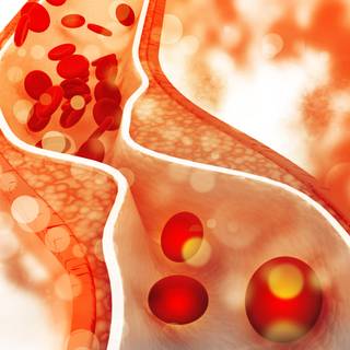 Cholesterol wallpaper