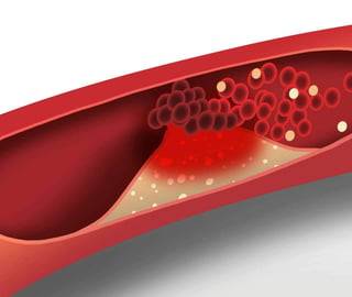 Cholesterol wallpaper