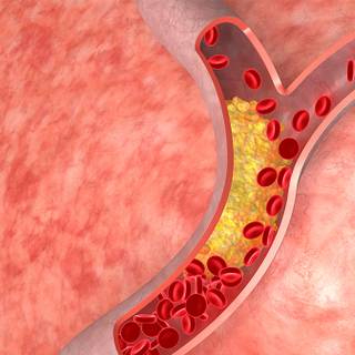 Cholesterol wallpaper