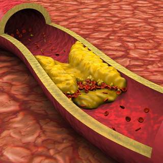 Cholesterol wallpaper