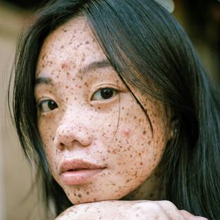 Pimple girl wallpaper
