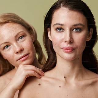 Pimple girl wallpaper