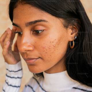 Pimple girl wallpaper