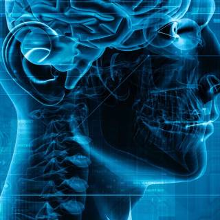 X-ray iPhone wallpaper