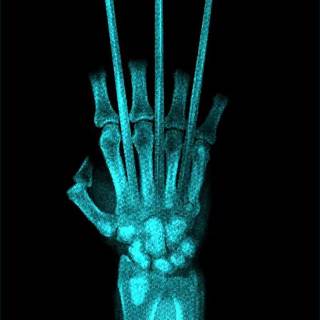 X-ray iPhone wallpaper