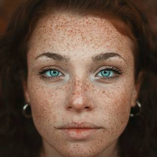 Hyperpigmentation wallpaper