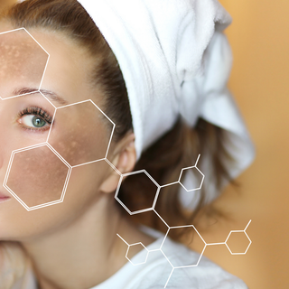 Hyperpigmentation wallpaper