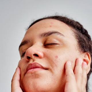 Hyperpigmentation wallpaper