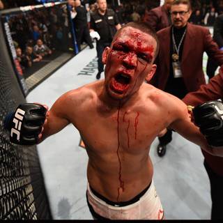 Nick Diaz desktop wallpaper