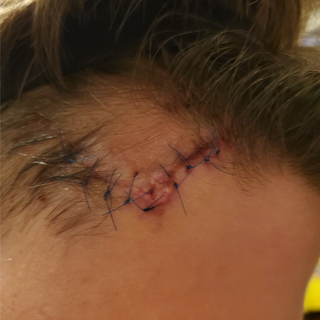 Tristan/baseball head