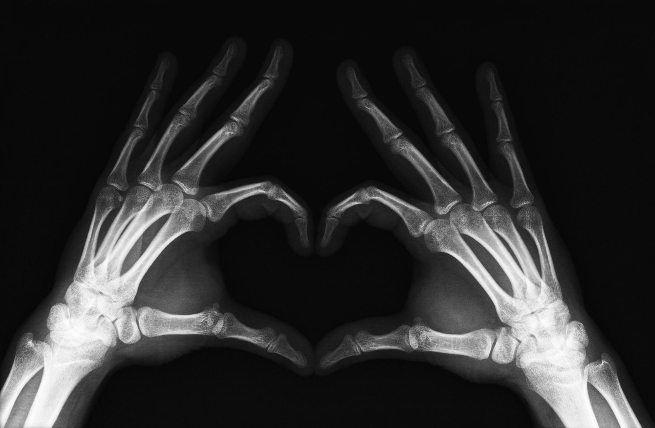 X_Ray_Heart_by_