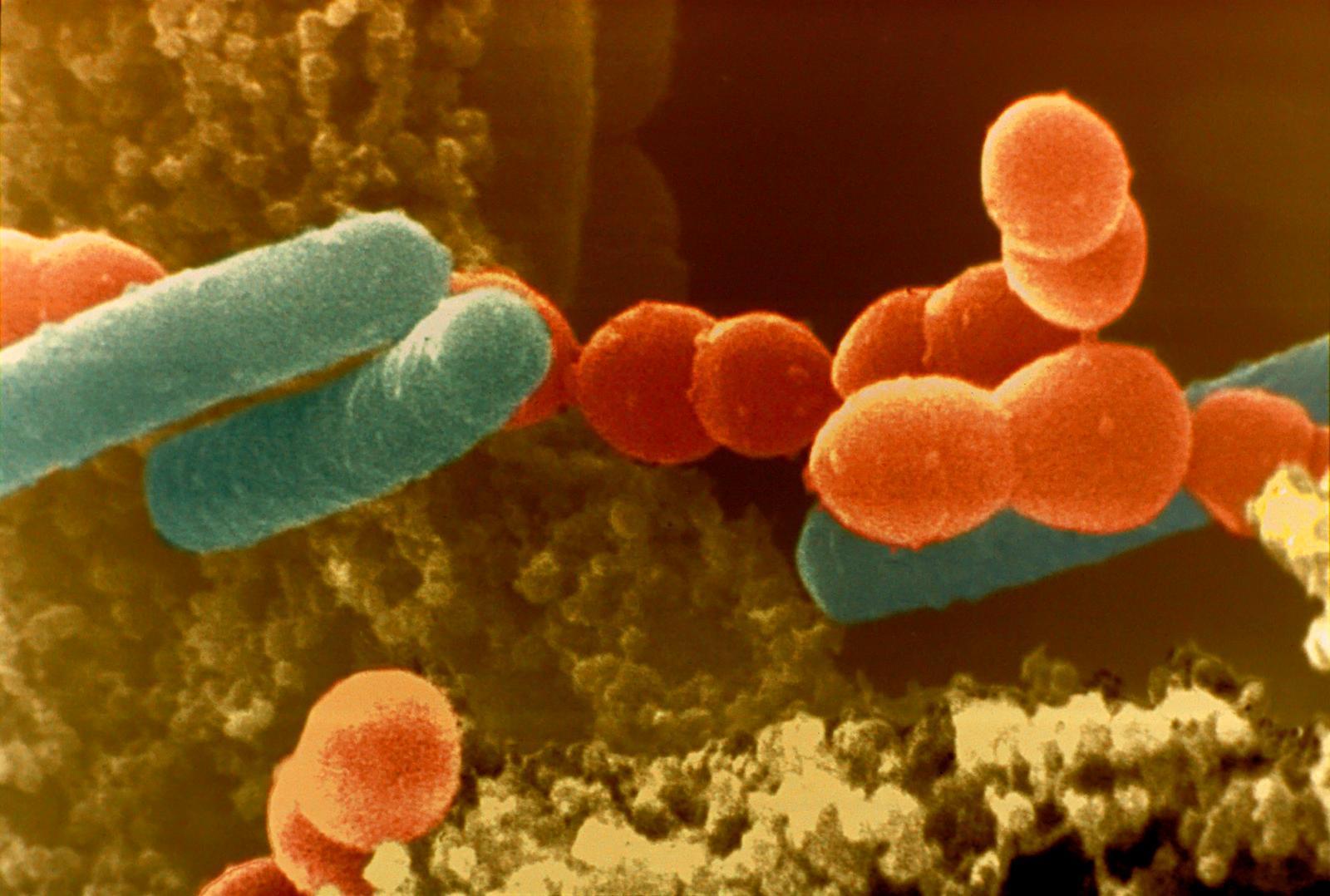 image For > Bacteria In Yogurt Lab