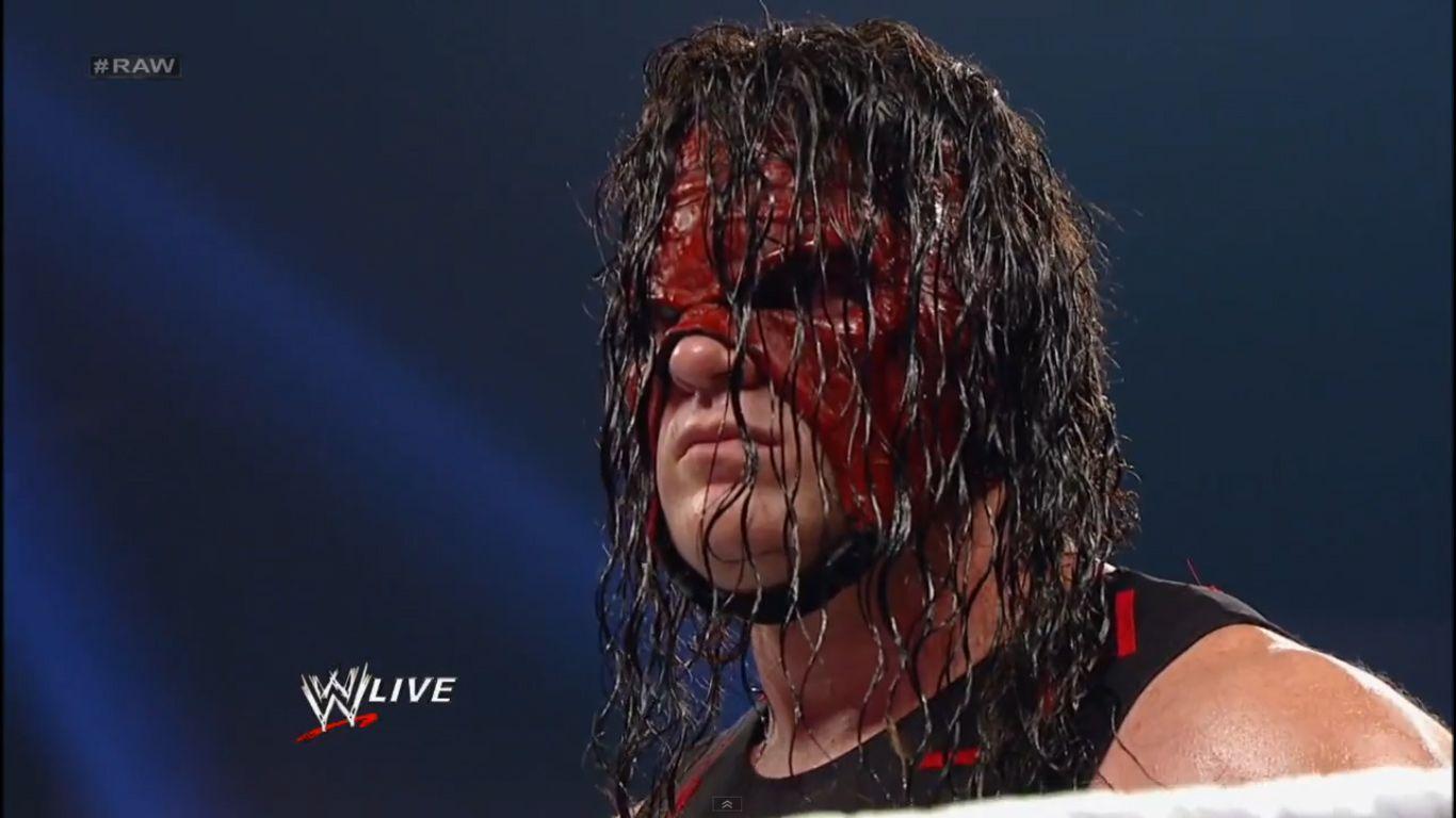 Update On Kane Losing His Mask