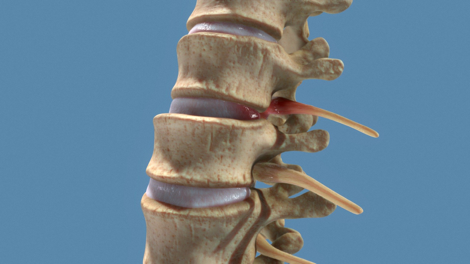Human Spinal Injury Anatomy model by INTERVOKE [3D64734]