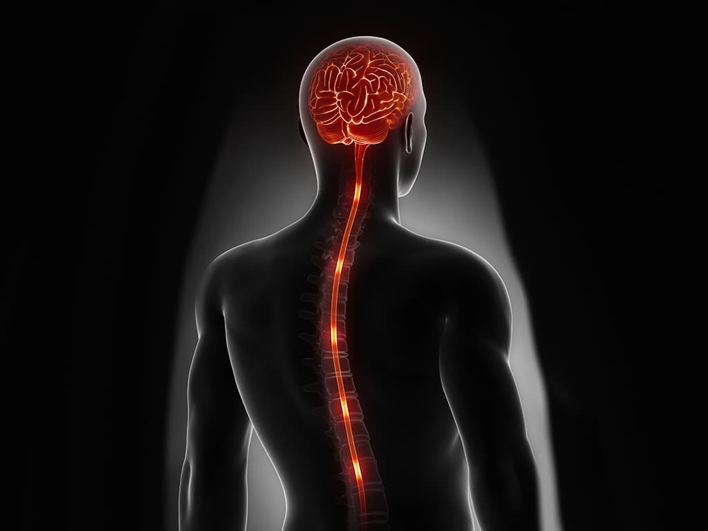 Spinal Cord Stroke: What is it and How is it Caused?