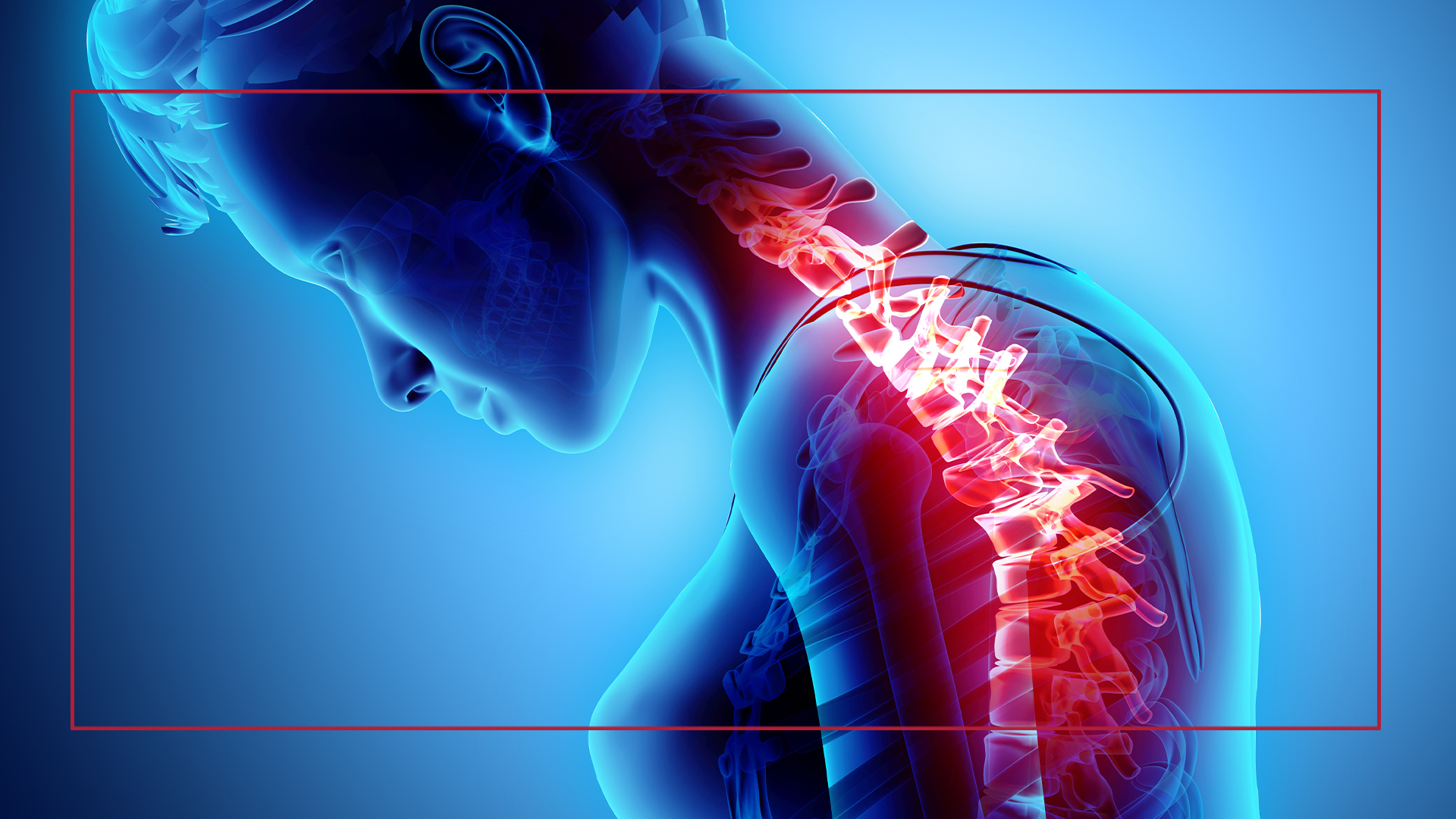 Boca Raton Spinal Cord Injury Lawyer. West Palm Beach