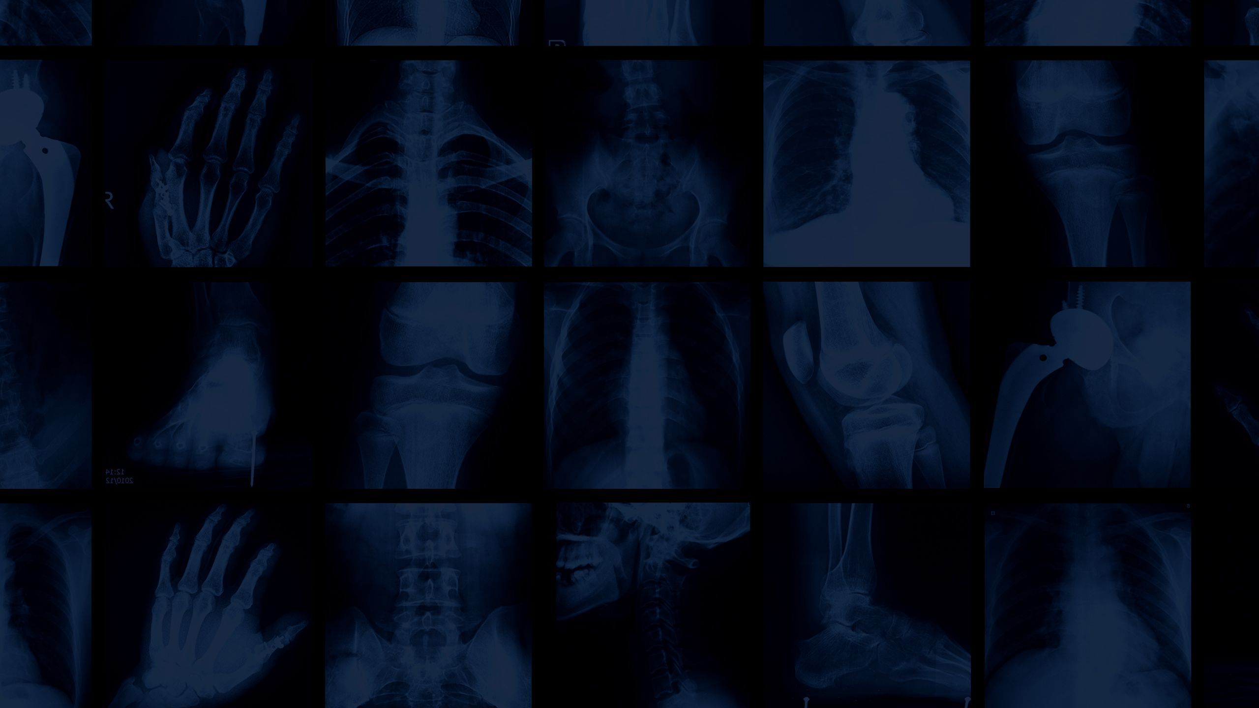 Orthopedic Wallpaper