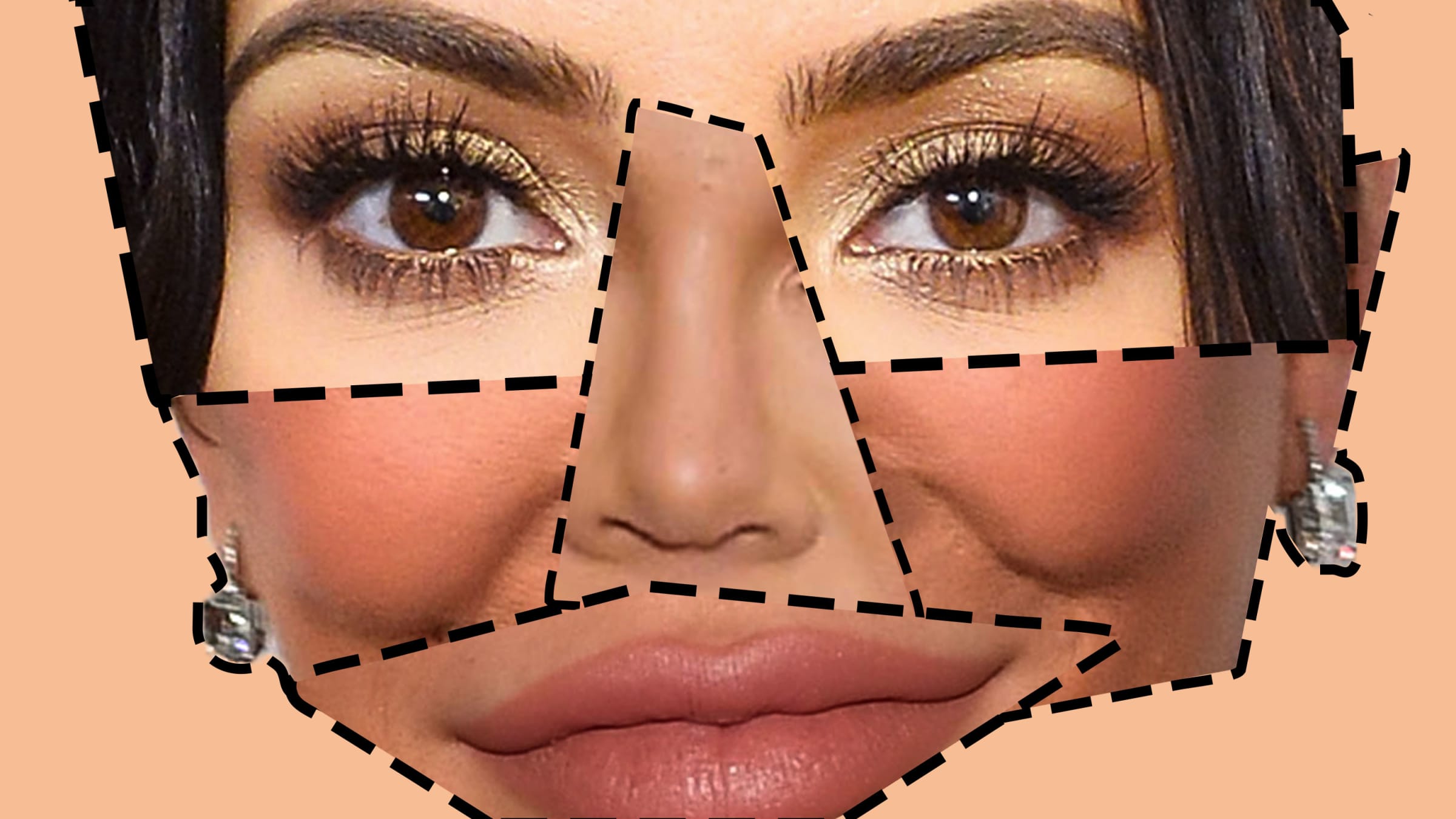 How the Kardashians Changed the Face of Plastic Surgery