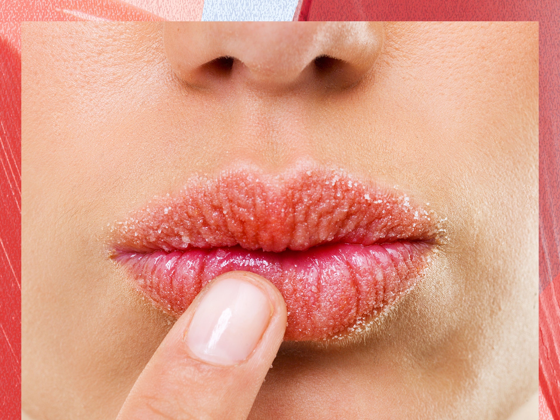 Why My Lips Are Dry All The Time