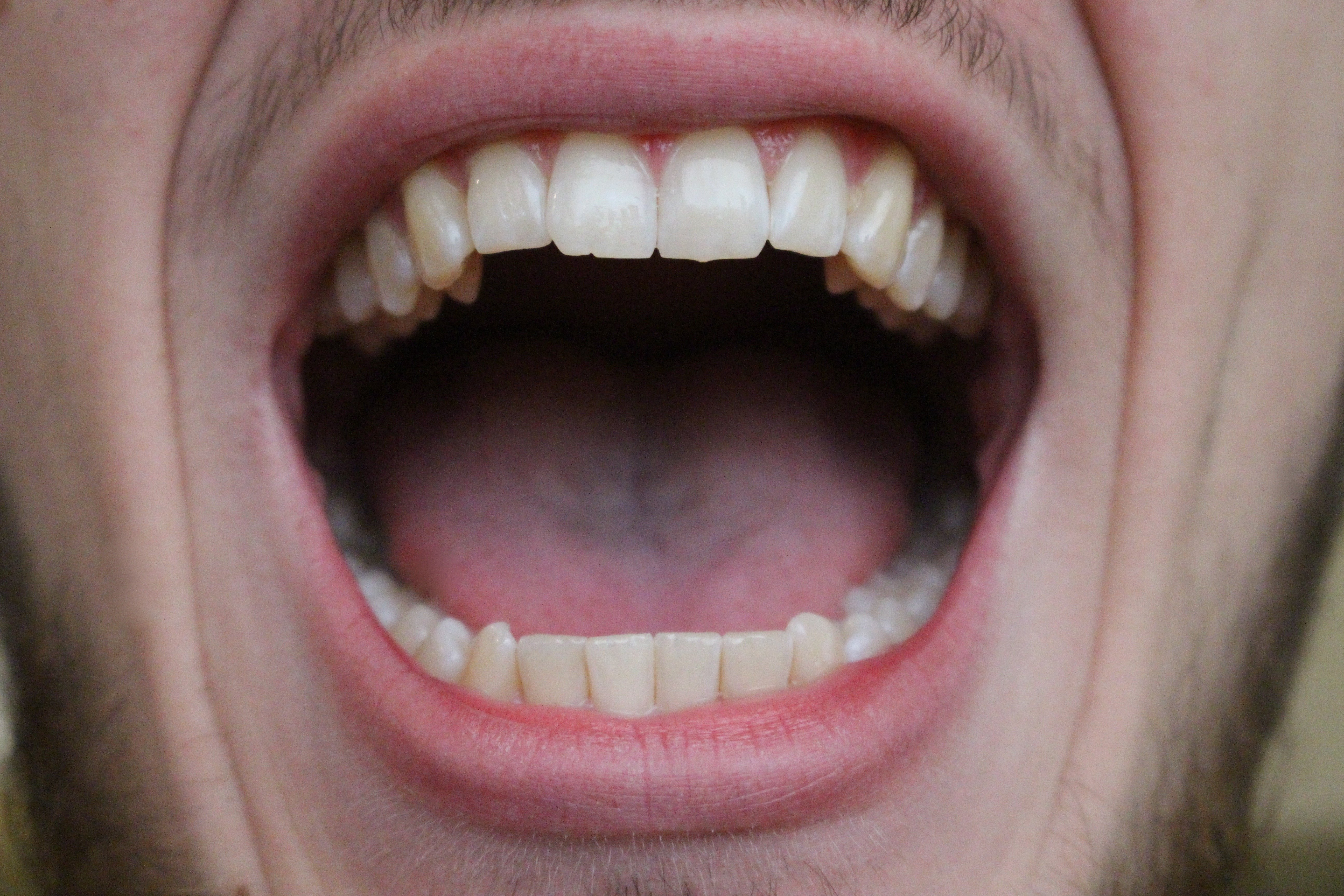 Free photo: Open mouth, Mouth, Open