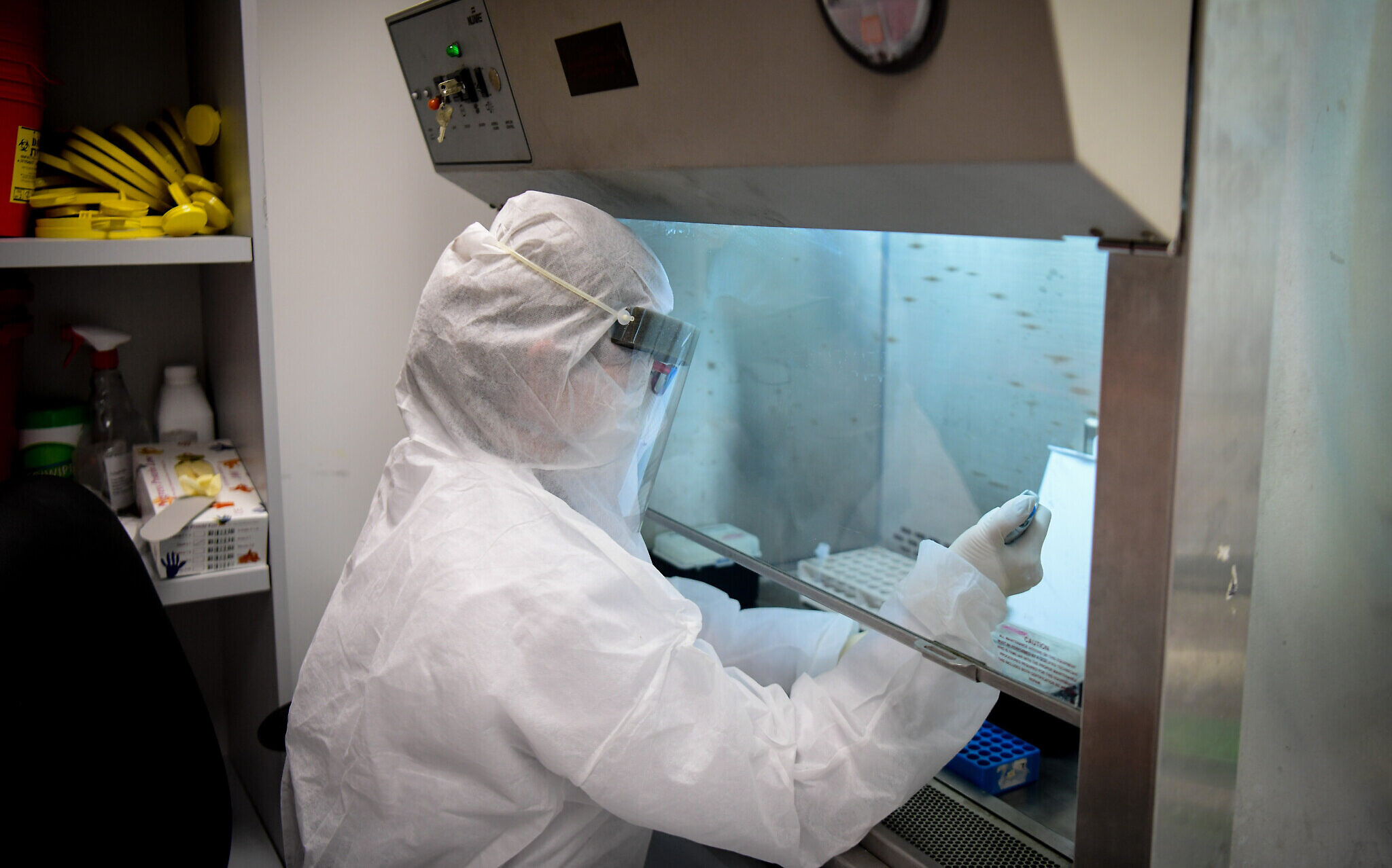 Medical labs say they're not being allowed to work at full capacity on Shabbat. The Times of Israel