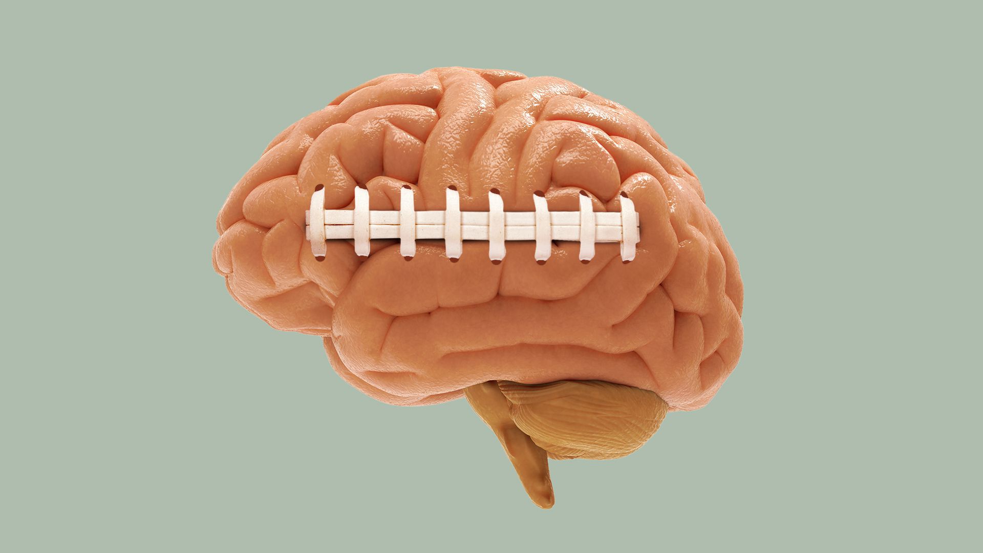 Concussion study inspires practice limits to college football preseason
