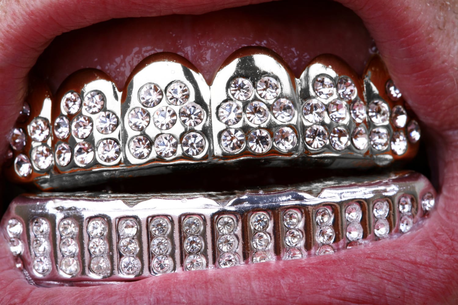 TYPES OF GRILLZ: WHAT ARE THEIR DIFFERENCES? Gold Grillz