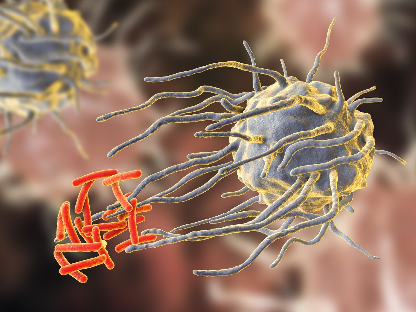 Antibiotic drug resistance is creating a global crisis, UN report says