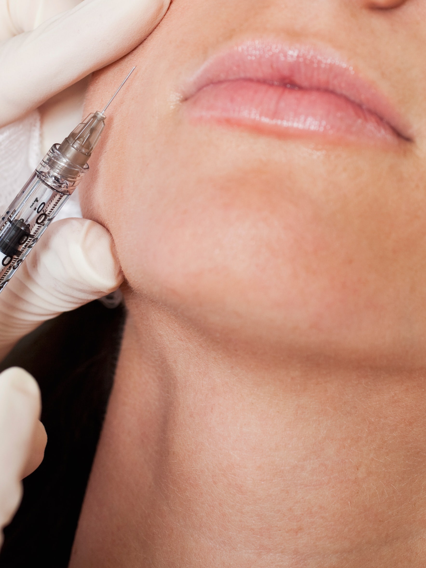Baby Botox: What It Is, Side Effects, Cost, and Risks